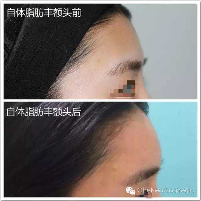 人造肉能解决吃肉问题吗？上市价格比大龙虾贵