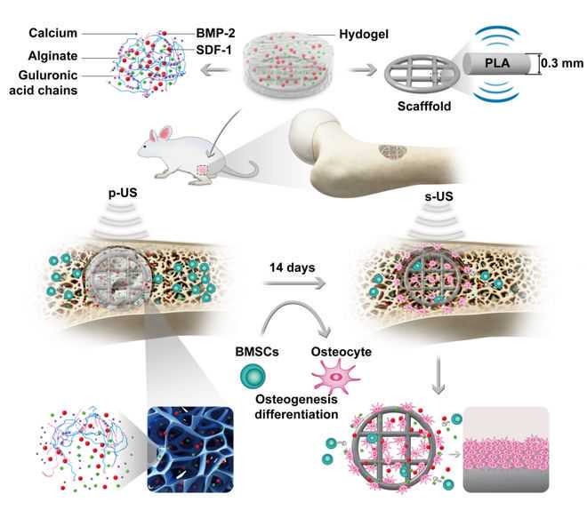 致敬！兰陵90后退役军人李春林捐献造血干细胞