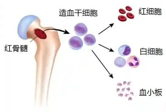 体检发现脾脏肿大，警惕“中招”骨髓纤维化